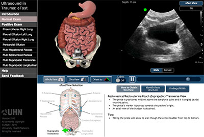 Normal Exam: Suprapubic Transverse View - probe position