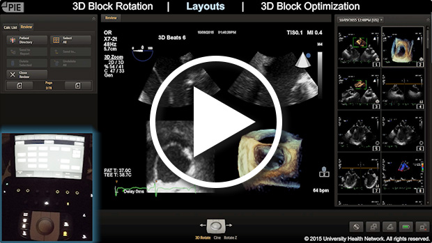 Philips Epiq 7 - 3D Display and Optimization